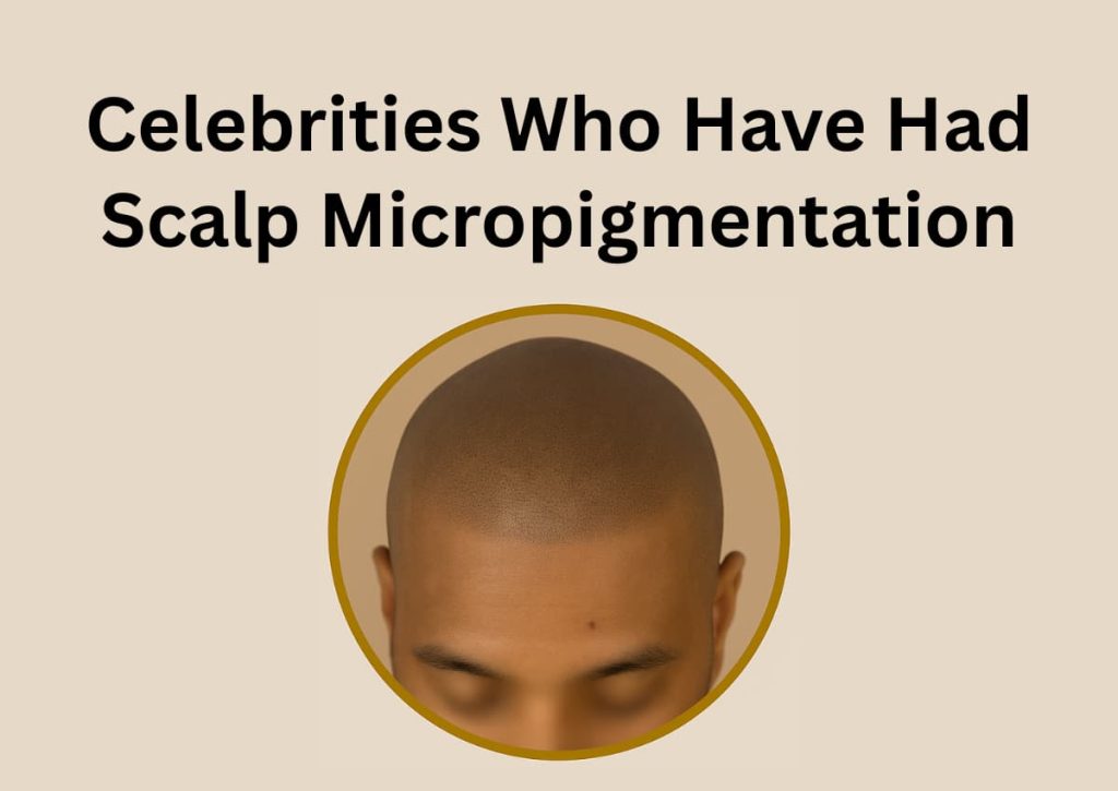 Celebrities Who Have Had Scalp Micropigmentation