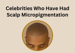 Celebrities Who Have Had Scalp Micropigmentation