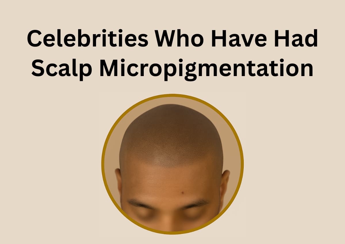 Celebrities Who Have Had Scalp Micropigmentation